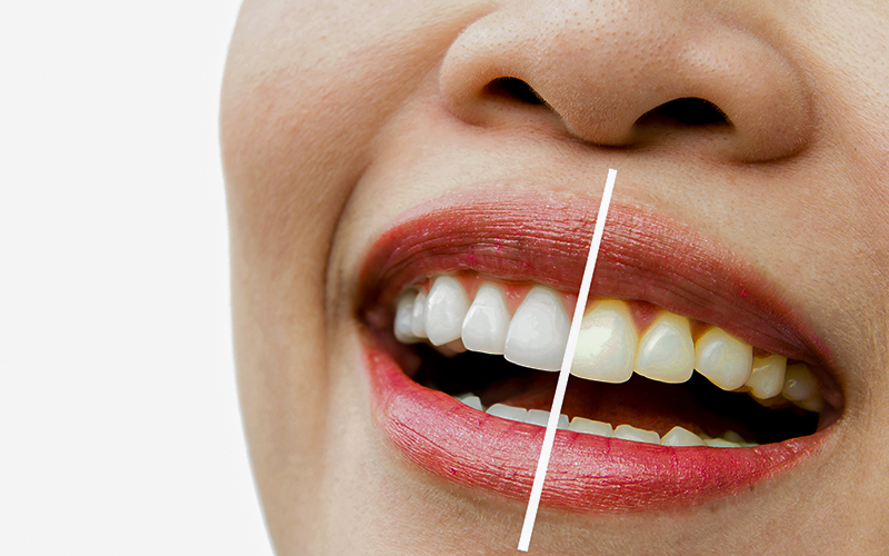  کلینیک و مطب دندانپزشکی دکتر طناز احدیان ،  dr. tannaz ahadian clinic dental studio, کامپوزیت و لمینیت دندان، بلیچینگ، جرم گیری، خدمات دندانپزشکی شمال و شمال غرب تهران، زعفرانیه، مقدس اردبیلی