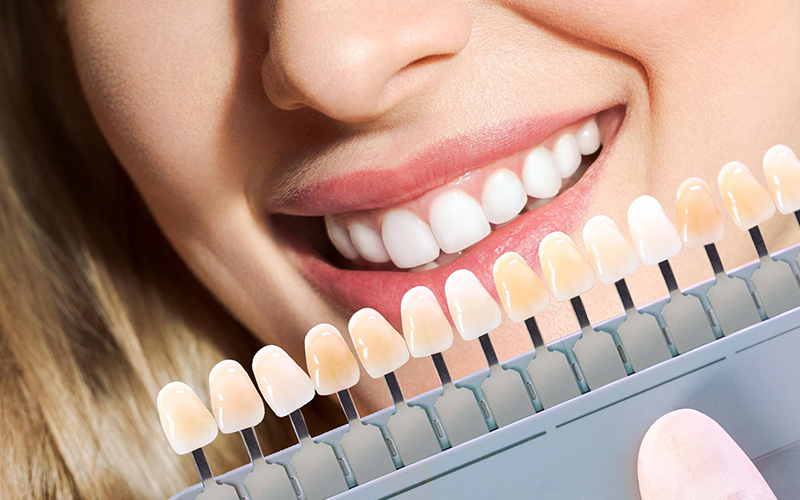  کلینیک و مطب دندانپزشکی دکتر طناز احدیان ،  dr. tannaz ahadian clinic dental studio, کامپوزیت و لمینیت دندان، بلیچینگ، جرم گیری، خدمات دندانپزشکی شمال و شمال غرب تهران، زعفرانیه، مقدس اردبیلی